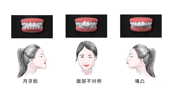 牙齒矯正